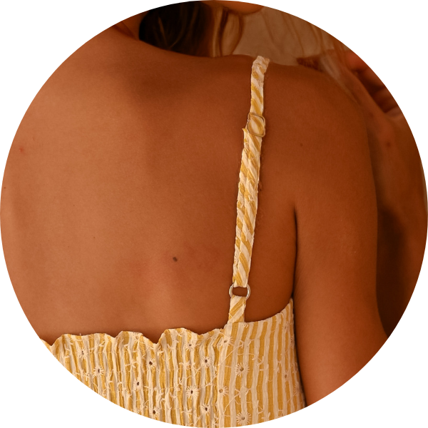 28